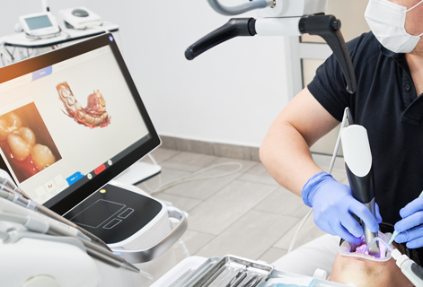 歯のクリーニング